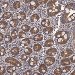 ARMCX1 Antibody, Novus Biologicals 25 &mu;L; Unlabeled:Antibodies, Polyclonal
